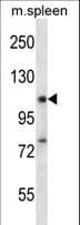 Polyclonal Rabbit anti-Human RBM12 Antibody (aa575-603, IHC, WB)
