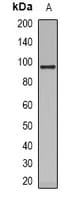 VAV1 / VAV Antibody (Internal)