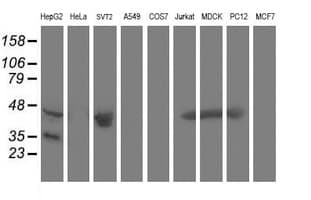 ACY1 / Aminoacylase 1 Antibody (clone OTI1A12)