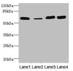 IHC-plus™ Polyclonal Rabbit anti-Human THBD / CD141 / Thrombomodulin Antibody (IHC, WB)