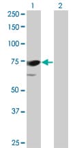 PPEF / PPEF1 Antibody (clone 1F6-1A5)