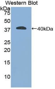 GFAP Antibody (aa70-374, FITC)
