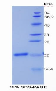 Human COL15A1 / Collagen XV Alpha 1 Protein (Recombinant His)