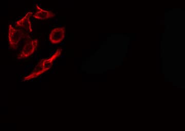 COL9A1 / Collagen IX Antibody