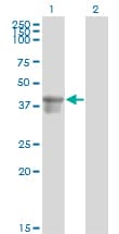Monoclonal Mouse anti-Human SERPINB3 Antibody (clone 2F5, WB)