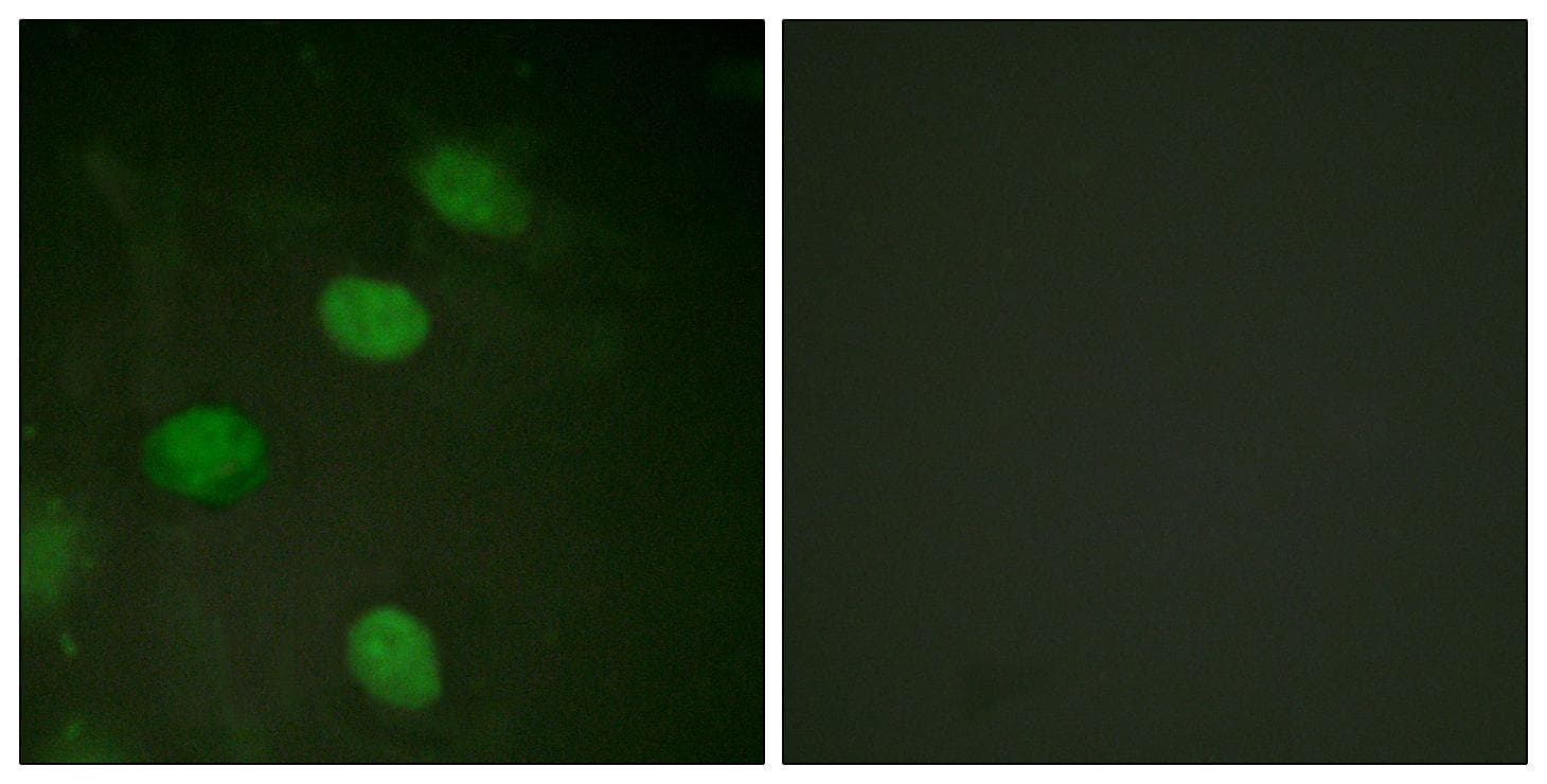Polyclonal Rabbit anti-Human JUN / c-Jun Antibody (phospho-Thr231, IHC, IF)