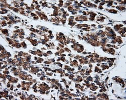 PTPRE / PTP Epsilon Antibody (clone OTI5F2)
