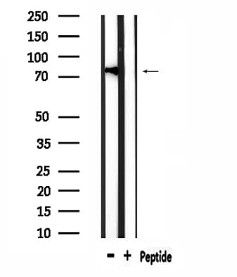 ERIC-1 / TACC3 Antibody