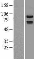 PRICKLE1 Protein (Over-Expression Lysate Myc-DDK (Flag))