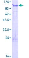 Human ALS2CR11 Protein (Recombinant GST)