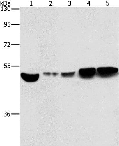 PathPlus™ Polyclonal Rabbit anti-Human ENO1 / Alpha Enolase Antibody (IHC, WB)