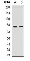 PPP2R3B Antibody