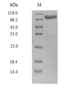 Human CAPN14 Protein (Recombinant 10His, N-terminus + Myc, C-terminus)