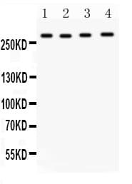 Polyclonal Rabbit anti-Human IGF2R / CD222 Antibody (aa2475-2491, IHC, WB)