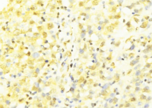 HAX-1 Antibody