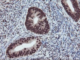 FMR1 / FMRP Antibody (aa36-279, clone OTI5B9)