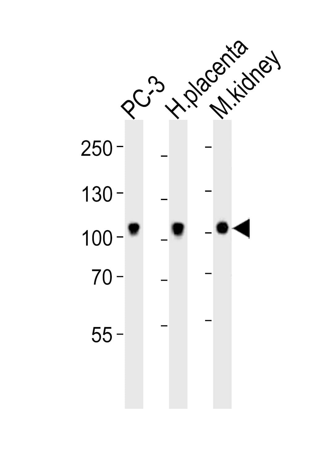 EPHB4 / EPH Receptor B4 Antibody (aa889-923)