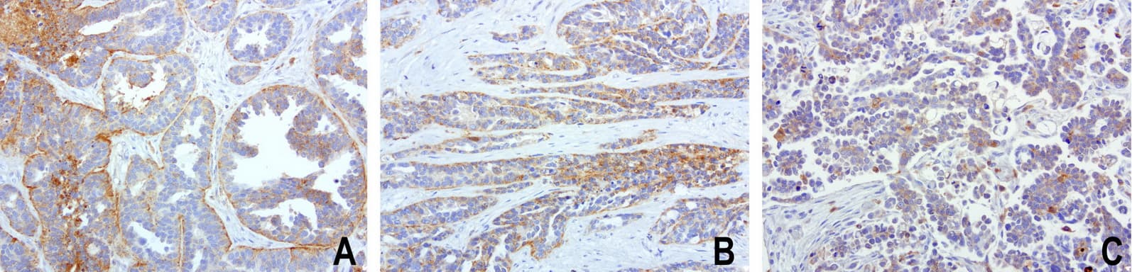 SDCBP / Syntenin Antibody (clone UMAB69)