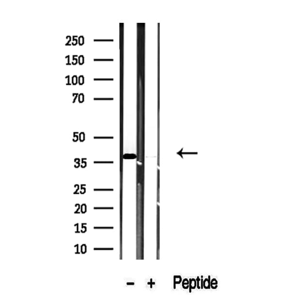 TMOD4 Antibody