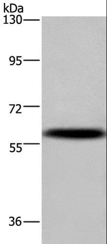 Polyclonal Rabbit anti-Human KV6.4 / KCNG4 Antibody (IHC, WB)