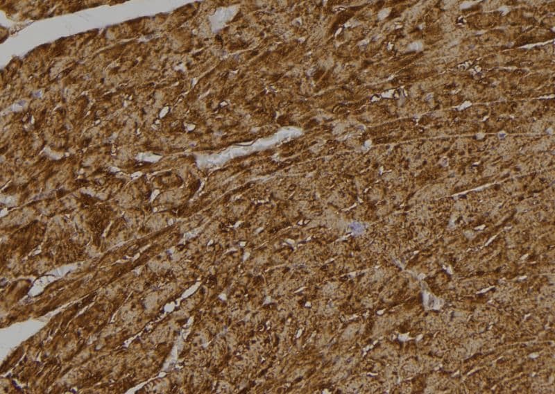 CASP6 / Caspase 6 Antibody (Cleaved Asp179)