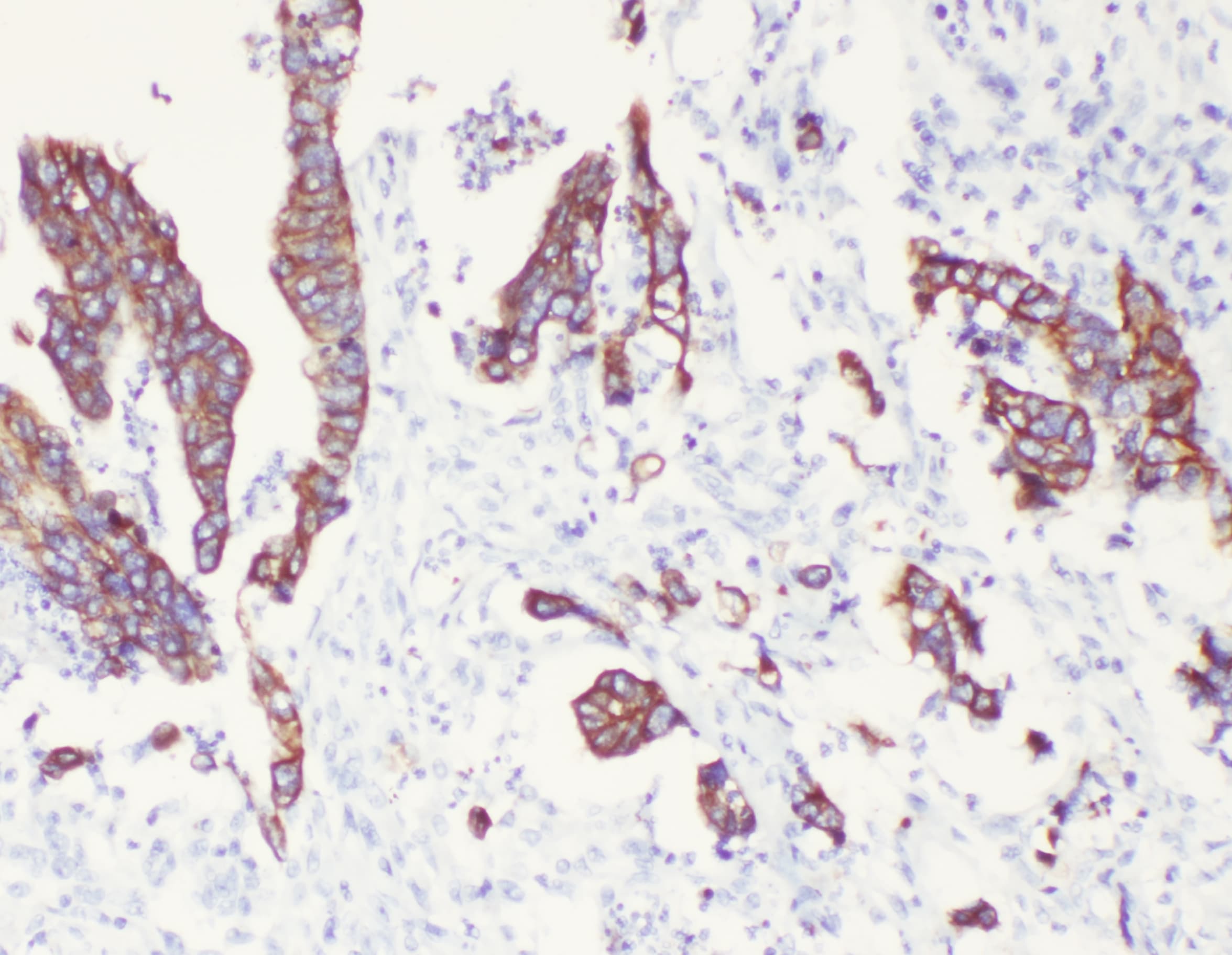 KRT8 / CK8 / Cytokeratin 8 Antibody