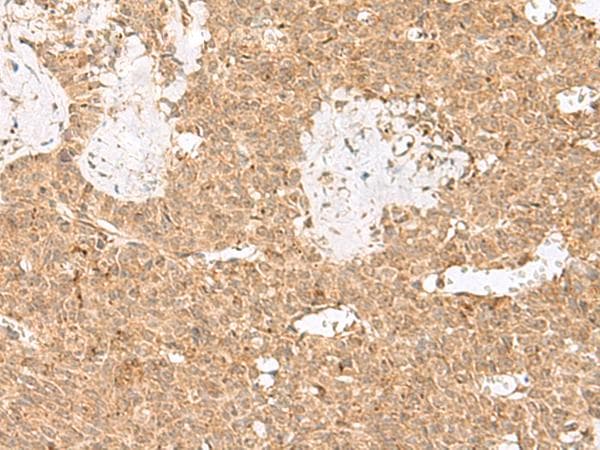 LGALSL / Galectin 5 Antibody