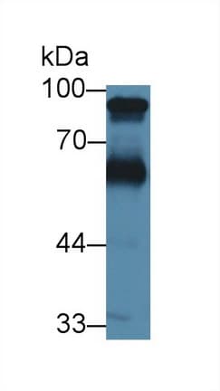 KNG1 / Kininogen / Bradykinin Antibody (PE)