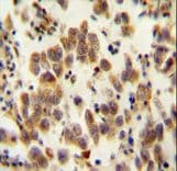 Polyclonal Rabbit anti-Human OR8B8 Antibody (aa280-308, IHC, WB)
