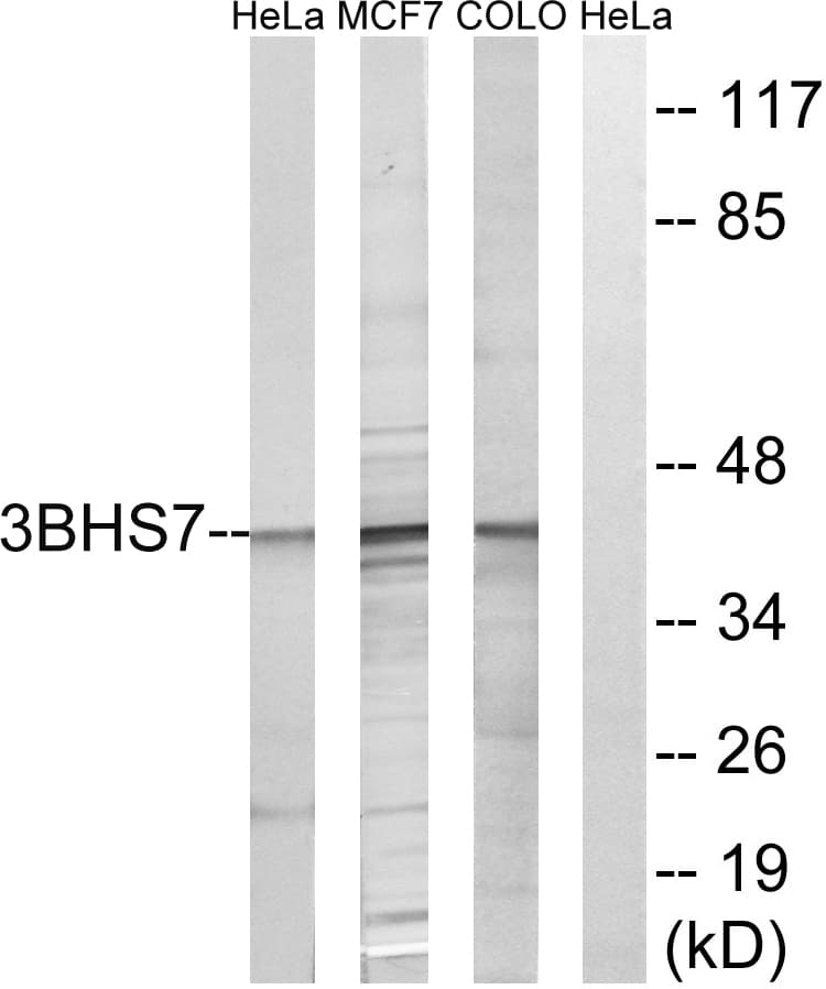 IHC-plus™ Polyclonal Rabbit anti-Human HSD3B7 Antibody (aa121-170, IHC, WB)