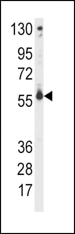 CYP2C9 / Cytochrome P450 2C9 Antibody (aa235-265)