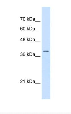 Polyclonal Rabbit anti-Human STRAP / MAWD Antibody (aa101-150, IHC, WB)