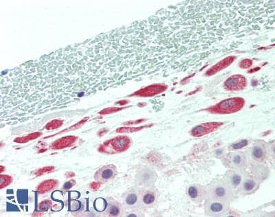 TADA2L / ADA2A Antibody (Internal)