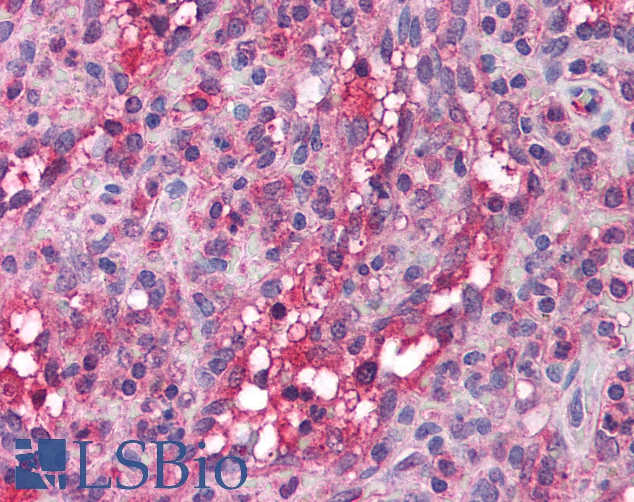 APOBEC3G / CEM15 Antibody (aa51-100)