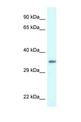 PDLIM1 Antibody (aa216-265)