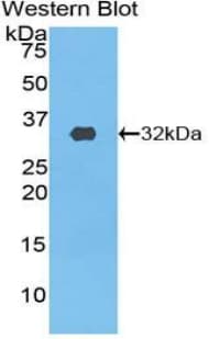 PIK3C2B Antibody (aa790-1025)