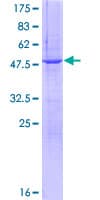 Human C1QTNF5 / CTRP5 Protein (Recombinant GST)