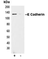 PathPlus™ CDH1 / E Cadherin Antibody (C-Terminus)