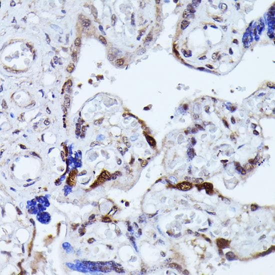 Polyclonal Rabbit anti-Human KIAA1429 Antibody (IHC)