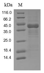Human TAB2 Protein (Recombinant 10His, N-terminus + Myc, C-terminus)