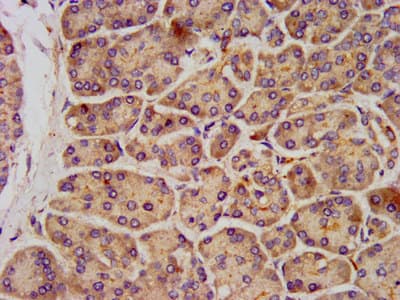 KCNK3 / OAT1 Antibody