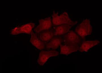 Polyclonal Rabbit anti-Human MAPK1 / ERK2 Antibody (IF, WB)