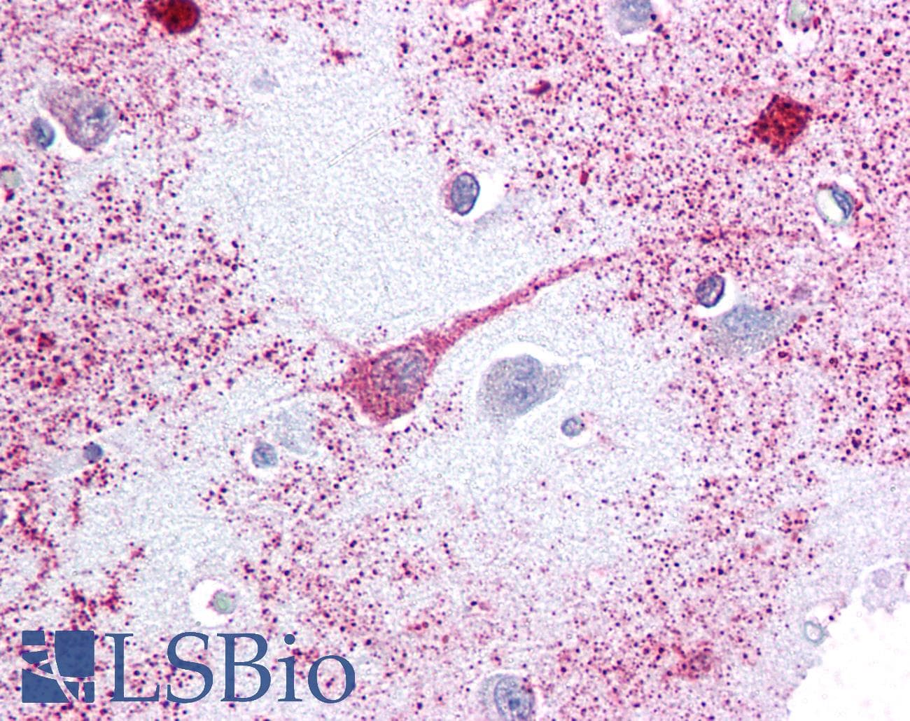 IHC-plus™ PTGER3 / EP3 Antibody (Cytoplasmic Domain)