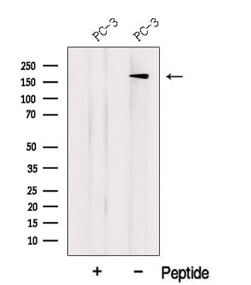 LTBP2 Antibody