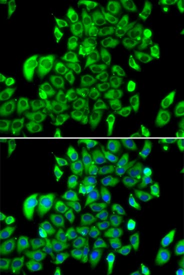 RPL13 / Ribosomal Protein L13 Antibody