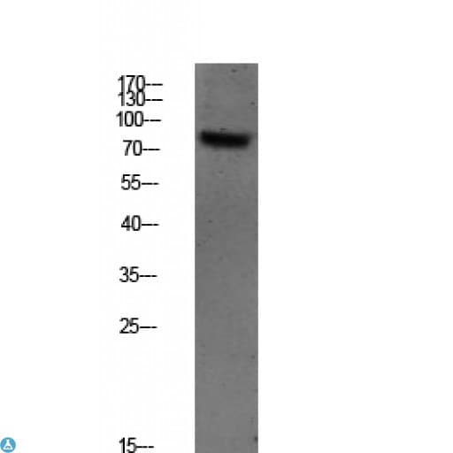 SYK Antibody (Tyr348)