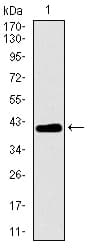 Monoclonal Mouse anti-Human MRPL42 / MRPS32 Antibody (clone 3H6H2, aa10-142, IHC, WB)