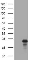 VILIP / VSNL1 Antibody (aa2-191, clone OTI2E5)