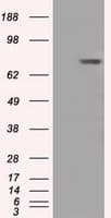 BTK Antibody (clone OTI3E9)