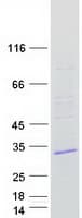 Human TMEM41A Protein (Recombinant Myc-DDK (Flag))